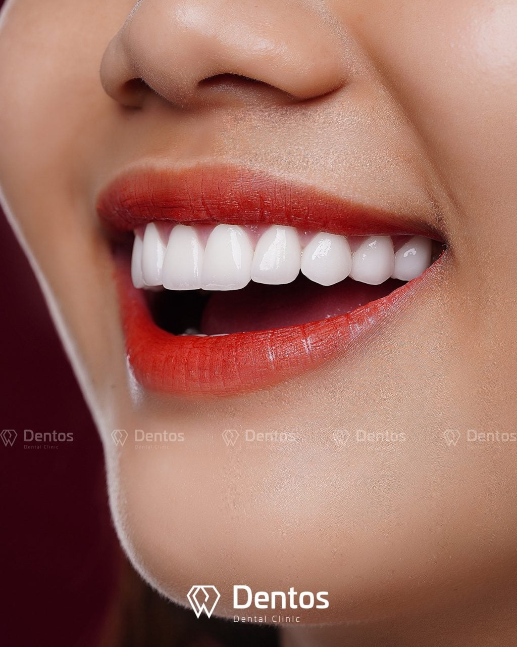 Dentos giúp bạn giữ nguyên vẻ tự nhiên để trở thành phiên bản đẹp hơn của chính mình